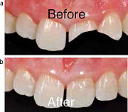 Let restore your smile from Ikeja