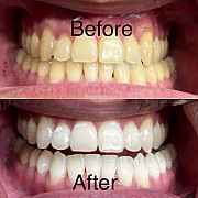 Let restore your smile from Ikeja