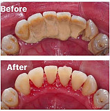 Let restore your smile from Ikeja