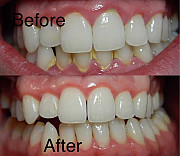 Let restore your smile from Ikeja