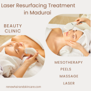 Renew Plus Laser Resurfacing Treatment in Madurai - Achieve Madurai