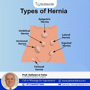 Dr. Safwan Taha: Specialist in Multimodal Obesity Treatment Dubai