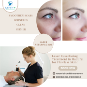 Laser Resurfacing Treatment in Madurai – Renew Hair and Skin Care Madurai