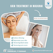 Expert Skin Treatment in Madurai - RenewHairAndSkinCare Madurai