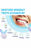 Best Teeth Whitening Kit for Sensitive Teeth | 32X LED Light & Enamel-Safe Formula! Los Angeles