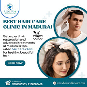 Best Hair Care Clinic in Madurai – Renew Hair & Skin Care from Madurai