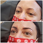 Microblading Vancouver: Redefine Your Beauty Vancouver