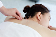 Acupuncture Toronto: Awakens Inner Calm and Healing at King Thai Massage Toronto