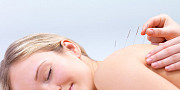 Acupuncture Treatment in Thornhill: Ancient Practice, Modern Results Toronto