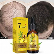 7 Days Eelhoe Germinal Oil – Fast Hair Growth & Nourishment Los Angeles