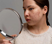 Trusted Pigmentation Treatment in Dubai for Radiant Skin from Dubai