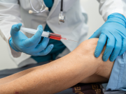 Acesso Biologics | Amniotic Membrane Graft for Wounds Phoenix