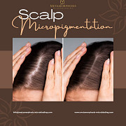 Scalp Micropigmentation : The Non-Surgical Revolution Vancouver
