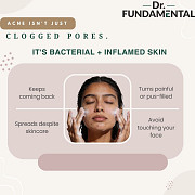 Best Gentle Cleanser for Oily Skin & Acne | Gel Based Oil Control Face Wash Jaipur