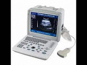 Laptop Ultrasound Machine with convex Probe IN NIGERIA BY SCANTRICK MEDICAL SUPPLIES from Gusau