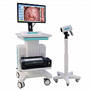 CAPOLSCOPY MACHINE IN NIGERIA BY SCANTRIK MEDICAL SUPPLIES from Sokoto