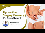 Liposuction Surgery Procedure in Delhi Delhi